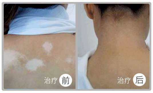 阜陽皮膚病醫(yī)院